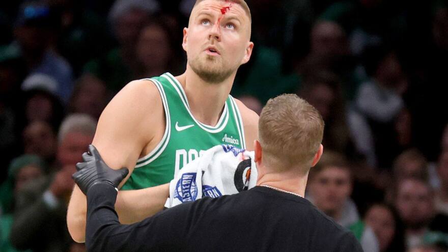 Kristaps Porzingis pley-off oʻyinida yuzidan jarohat oldi